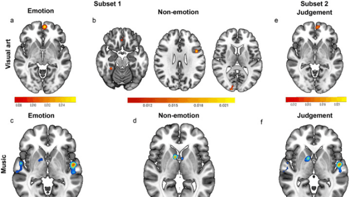 Distinct neural bases of visual art- and music-induced aesthetic experiences